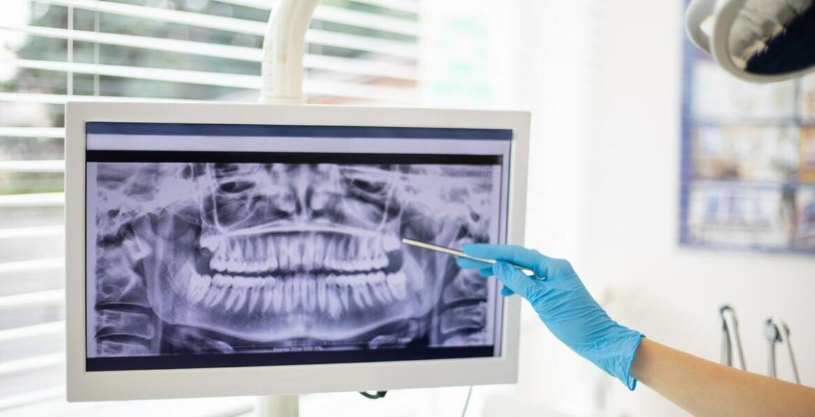 Rola rentgenodiagnostyki w planowaniu leczenia stomatologicznego na Woli