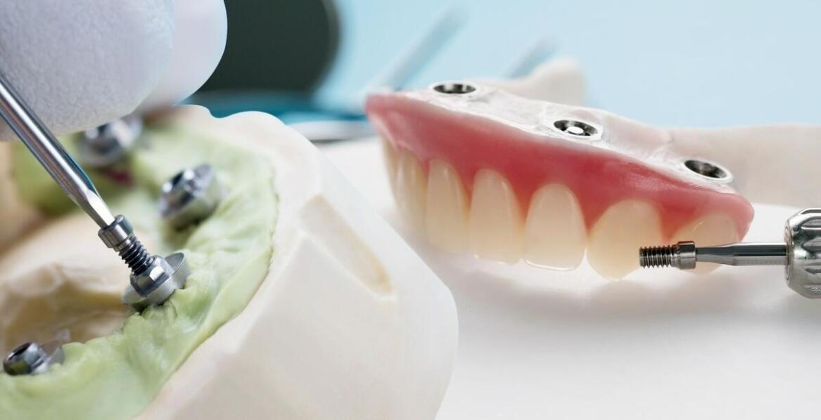 Nowoczesne podejście do protetyki – jak zaawansowane technologie poprawiają komfort użytkowania?