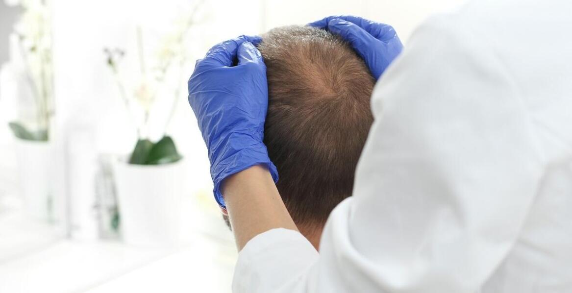 Kortyzol a problemy z głową skóry – kompleksowe podejście do leczenia