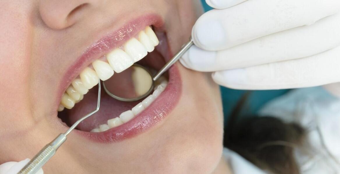 Jak usuwanie nazębnego kamienia wpływa na świeżość oddechu?