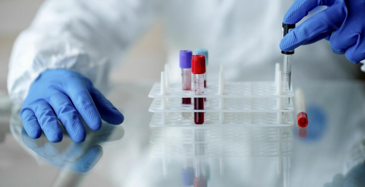 Znaczenie badań krwi w diagnostyce chorób u domowych zwierząt