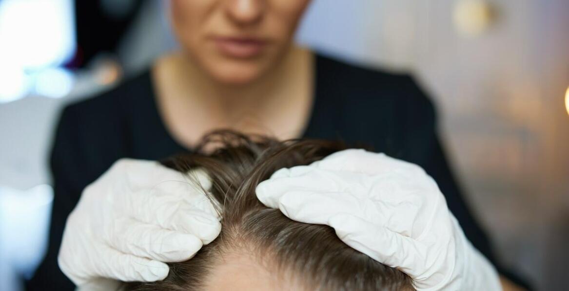 Rola detoksykacji głowy skóry w leczeniu łupieżu i łojotoku