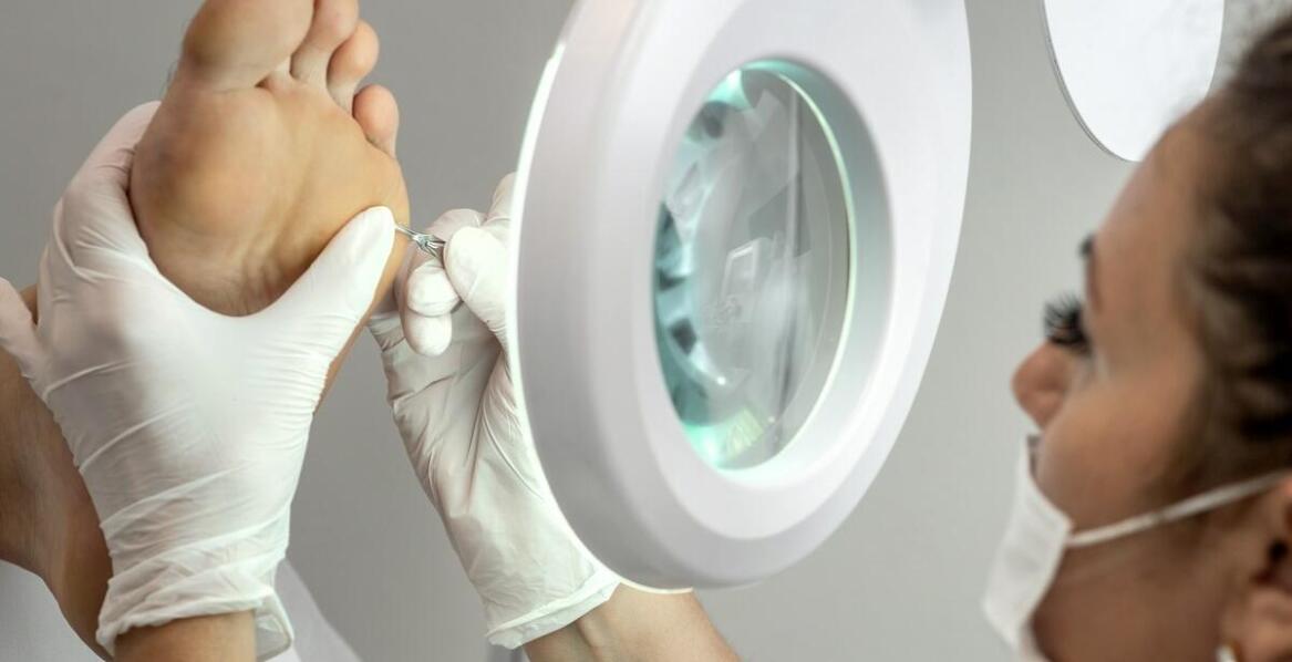 Nowoczesne metody korekcji wrastających paznokci i ich wpływ na zdrowie stóp