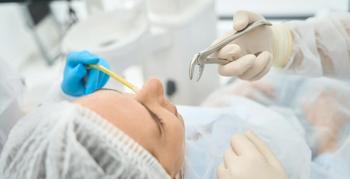 Ekstrakcja zębów mądrości – kiedy jest konieczna chirurgiczna interwencja?