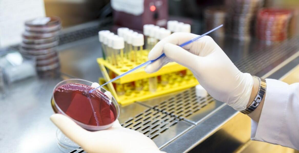 Badania na grzybicze infekcje: kompleksowa diagnostyczna oferta