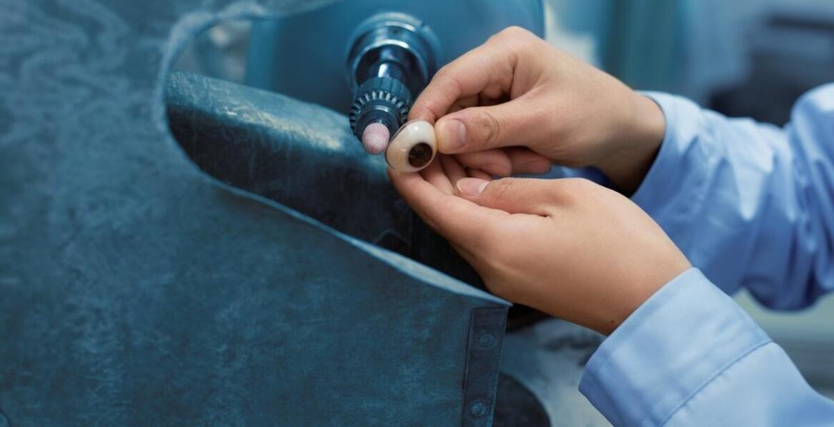 Jak dbać o porcelanowe korony, aby zachowały swój blask?