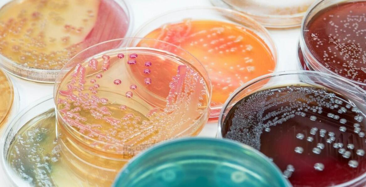 Why are plastic petri dishes preferred in biological laboratories?